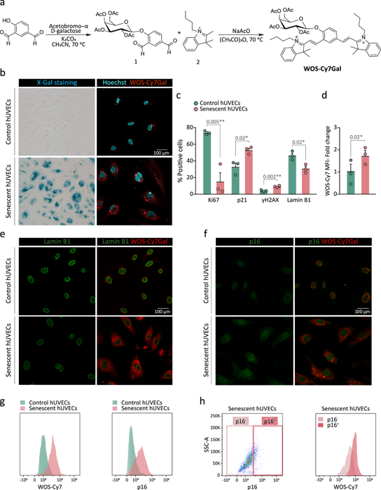 Centric 63-71 Mercedes-Benz 200 Loaded Front Left Rebuilt Caliper (R&R Only)