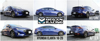 Megan Racing Hyundai Elantra Sport 16-20 (Multi-Link Rear Suspension) Street Series Coilovers - MR-CDK-HYE16S